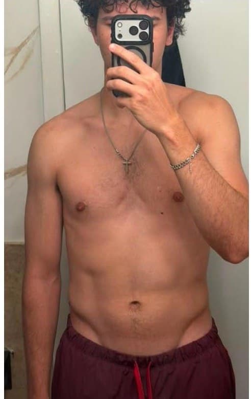 Alex after